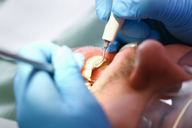 Best Dentist for Tooth Abscess  in Inglenook, CT